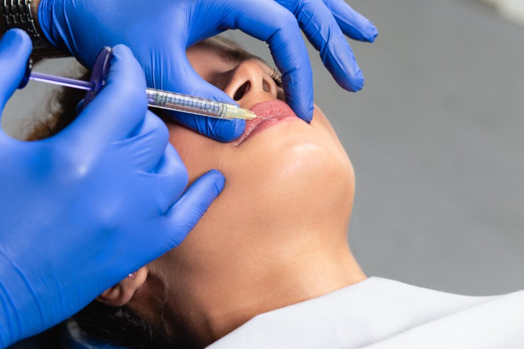 Close-up of dermal filler being injected into lips.